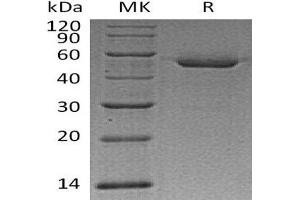 Cathepsin D Protein (CTSD) (His tag)