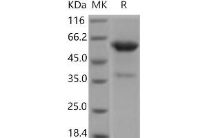 Western Blotting (WB) image for Collagen, Type IV, alpha 3 (COL4A3) protein (Fc Tag) (ABIN7321080) (COL4a3 Protein (Fc Tag))