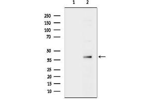 anti-Sorting Nexin 16 (SNX16) antibody