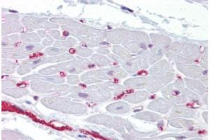 anti-Bone Morphogenetic Protein 10 (BMP10) (N-Term) antibody