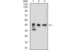 Western Blotting (WB) image for anti-Autophagy related 4B Cysteine Peptidase (ATG4B) (AA 1-221) antibody (ABIN7193465)