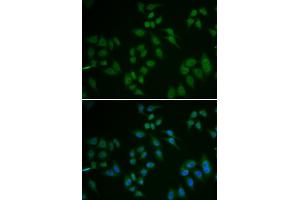 Immunofluorescence analysis of U2OS cell using TP63 antibody. (p63 抗体)