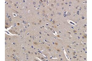 ABIN6259609 and ABIN6275532 at 1/100 staining rat brain tissue sections by IHC-P.