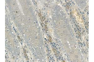 ABIN6256293 and ABIN6267140 at 1/100 staining human normal colon tissue by IHC-P. (MSK1 抗体  (pSer360))