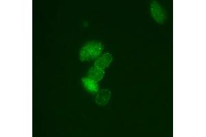 Immunofluorescence (IF) image for anti-Small Ubiquitin Related Modifier Protein 1 (SUMO1) (full length) antibody (FITC) (ABIN2452136) (SUMO1 抗体  (full length) (FITC))