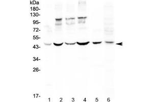 Western blot testing of human 1) HeLa, 2) MCF7, 3) HepG2, 4) A549, 5) rat spleen and 6) mouse thymus lysate with DC-SIGN antibody at 0. (DC-SIGN/CD209 抗体)