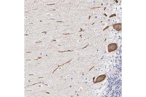 Immunohistochemical staining of human cerebellum with ELFN2 polyclonal antibody  shows strong cytoplasmic positivity in purkinje cells at 1:50-1:200 dilution. (ELFN2 抗体)