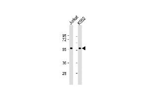 All lanes : Anti-MEF2C Antibody  at 1:1000 dilution Lane 1: Jurkat whole cell lysate Lane 2: K562 whole cell lysate Lysates/proteins at 20 μg per lane. (MEF2C 抗体  (AA 374-403))