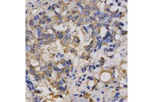 Immunohistochemistry (IHC) image for anti-Chloride Channel 5 (CLCN5) antibody (ABIN1876908) (Chloride Channel 5 抗体)