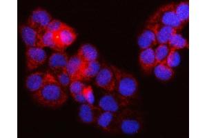 IF analysis of SURF1 using anti-SURF1 antibody (ABIN7601006).