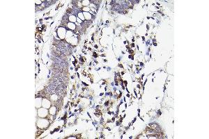 Immunohistochemistry (IHC) image for anti-Interleukin 6 Receptor (IL6R) (AA 20-320) antibody (ABIN3015522)