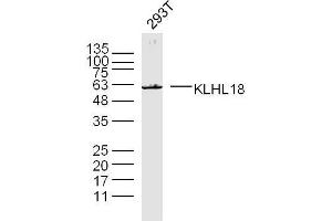 293T lysates probed with KLHL18 Polyclonal Antibody, unconjugated  at 1:300 overnight at 4°C followed by a conjugated secondary antibody for 60 minutes at 37°C. (KLHL18 抗体  (AA 451-550))