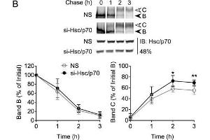 Hsc70/Hsp70 suppresses levels of mature CFTR. (HSP70/HSC70 抗体)