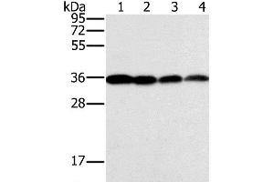 Western Blot analysis of Raji, Jurkat, 293T and hela cell using CENPV Polyclonal Antibody at dilution of 1:200 (CENPV 抗体)