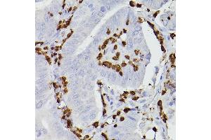 Immunohistochemistry (IHC) image for anti-S100 Calcium Binding Protein A9 (S100A9) (AA 1-114) antibody (ABIN6147345)