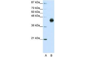 WB Suggested Anti-KRT18 Antibody Titration:  1. (Cytokeratin 18 抗体  (C-Term))