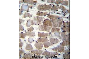 CTSK Antibody (Center E112) immunohistochemistry analysis in formalin fixed and paraffin embedded human skeletal muscle followed by peroxidase conjugation of the secondary antibody and DAB staining. (Cathepsin K 抗体  (AA 97-126))