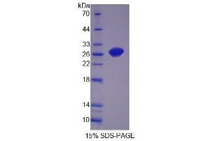 SDS-PAGE (SDS) image for Oligophrenin 1 (OPHN1) (AA 634-802) protein (His tag) (ABIN6239185)