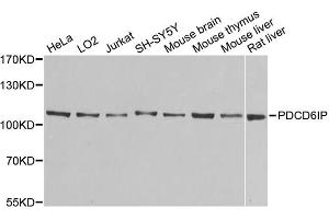 Western blot analysis of extracts of various cell lines, using PDCD6IP antibody (ABIN5971240) at 1/1000 dilution. (ALIX 抗体)