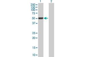 Western Blot analysis of GAL3ST4 expression in transfected 293T cell line by GAL3ST4 MaxPab polyclonal antibody. (GAL3ST4 抗体  (AA 1-486))