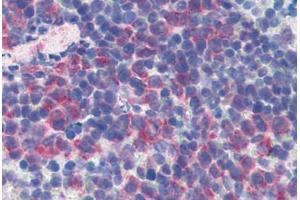 Mouse Spleen: Formalin-Fixed, Paraffin-Embedded (FFPE) (CD69 抗体  (FITC))