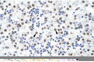 Rabbit Anti-MSI2 Antibody ,Paraffin Embedded Tissue: Human Liver  Cellular Data: Hepatocytes  Antibody Concentration: 4. (MSI2 抗体  (N-Term))