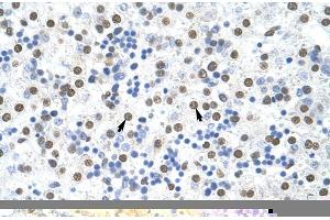 Rabbit Anti-MSI2 Antibody ,Paraffin Embedded Tissue: Human Liver  Cellular Data: Hepatocytes  Antibody Concentration: 4.