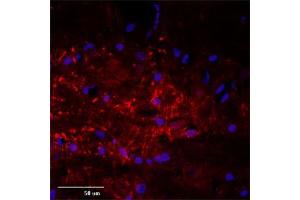 IF (confocal) on rat brain at a concentration of 30 µg/ml using Rabbit antibody to rat, mouse Mtap2 (Microtubule-associated protein 2, MAP-2, MAP 2, MAP2, MAP2R): IgG (ABIN350476), DAPI counterstained appearing in blue. (MAP2 抗体  (AA 350-400))