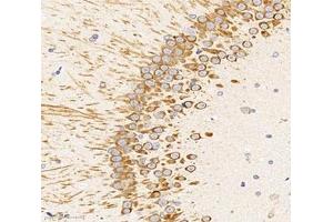 Immunohistochemistry analysis of paraffin-embedded rat hippocampus using,UNC5C (ABIN7076148) at dilution of 1: 2000