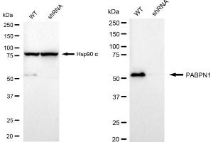 Western blotting analysis using PABPN1 antibody (ABIN7797755).