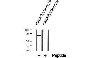 Western blot analysis of extracts from mouse skeletl muscle, using SEC24A antibody. (SEC24A 抗体  (Internal Region))