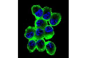 Confocal immunofluorescent analysis of MBP Antibody (Ascites) ABIN1539854 with NCI- cell followed by Alexa Fluor® 488-conjugated goat anti-mouse lgG (green). (MBP 抗体)