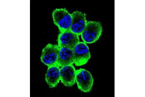 Confocal immunofluorescent analysis of MBP Antibody (Ascites) ABIN1539854 with NCI- cell followed by Alexa Fluor® 488-conjugated goat anti-mouse lgG (green). (MBP 抗体)