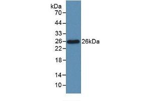 Detection of Recombinant Bcl2L, Rat using Monoclonal Antibody to B-Cell CLL/Lymphoma 2 Like Protein (Bcl2L) (BCL2L1 抗体  (AA 2-212))