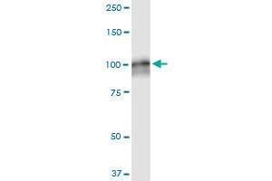 AMPD2 monoclonal antibody (M09A), clone 6A8. (AMPD2 抗体  (AA 86-185))