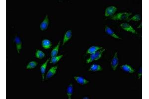 Immunofluorescent analysis of Hela cells using ABIN7170239 at dilution of 1:100 and Alexa Fluor 488-congugated AffiniPure Goat Anti-Rabbit IgG(H+L) (SLC35F6 抗体  (AA 337-371))