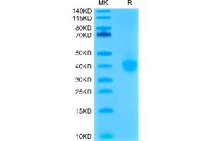 Cynomolgus PD-L1 on Tris-Bis PAGE under reduced condition. (PD-L1 Protein (AA 19-238) (His tag))