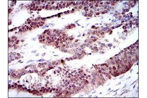 Immunohistochemistry (IHC) image for anti-Cytochrome P450, Family 1, Subfamily A, Polypeptide 1 (CYP1A1) antibody (ABIN969511)