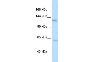 WB Suggested Anti-Ttbk2 Antibody   Titration: 1. (TTBK2 抗体  (N-Term))