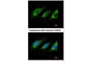 ICC/IF Image Immunofluorescence analysis of methanol-fixed HeLa, using AICDA, antibody at 1:500 dilution. (AICDA 抗体  (N-Term))