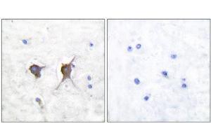 Immunohistochemistry (IHC) image for anti-BCL2-Associated X Protein (BAX) (N-Term) antibody (ABIN1848438) (BAX 抗体  (N-Term))