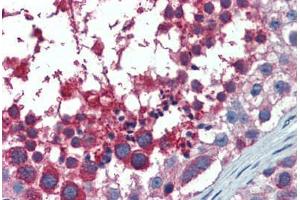 Human Testis: Formalin-Fixed, Paraffin-Embedded (FFPE) (USO1 抗体  (AA 1-962))