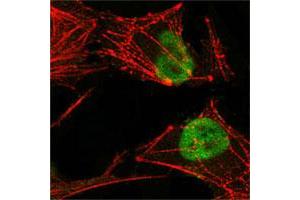 Confocal immunofluorescence analysis of HeLa cells using MSH2 monoclonal antibody, clone 1B3 (3A2B8C)  (green), showing nuclear localization. (MSH2 抗体)