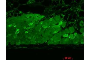 Immunohistochemistry (IHC) image for anti-Heat Shock Protein 90 (HSP90) antibody (Biotin) (ABIN2481301)