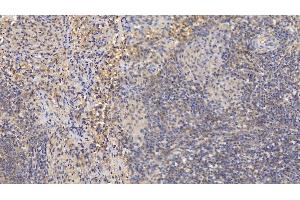 Detection of MMP8 in Human Spleen Tissue using Monoclonal Antibody to Matrix Metalloproteinase 8 (MMP8)