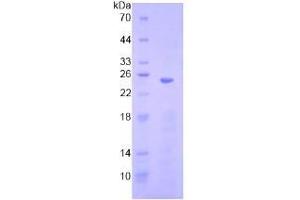SDS-PAGE analysis of Human HMG1 Protein. (HMGB1 蛋白)