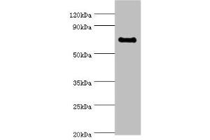 Western blot All lanes: TAF5L antibody at 10 μg/mL + Jurkat whole cell lysate Secondary Goat polyclonal to rabbit IgG at 1/10000 dilution Predicted band size: 67, 37 kDa Observed band size: 67 kDa (TAF5L 抗体  (AA 1-325))