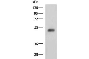 Western blot analysis of Human bladder transitional cell carcinoma grade 2-3 tissue lysate using SLC30A6 Polyclonal Antibody at dilution of 1:2000 (SLC30A6 抗体)