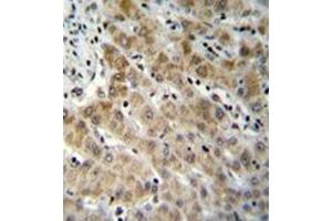 Formalin fixed and paraffin embedded human liver tissue reacted with Endothelin-1 Antibody (C-term) followed by peroxidase conjugation of the secondary antibody and DAB staining. (Endothelin 1 抗体  (C-Term))