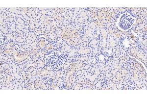Detection of PTPN13 in Human Kidney Tissue using Polyclonal Antibody to Protein Tyrosine Phosphatase, Non Receptor Type 13 (PTPN13) (PTPN13 抗体  (AA 1-161))